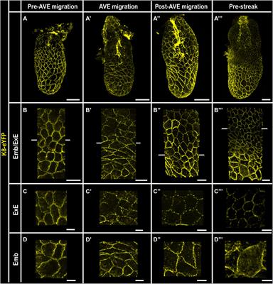 Regionally specific levels and patterns of keratin 8 expression in the mouse embryo visceral endoderm emerge upon anterior-posterior axis determination